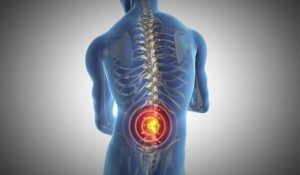Back pain treatment in Lancashire