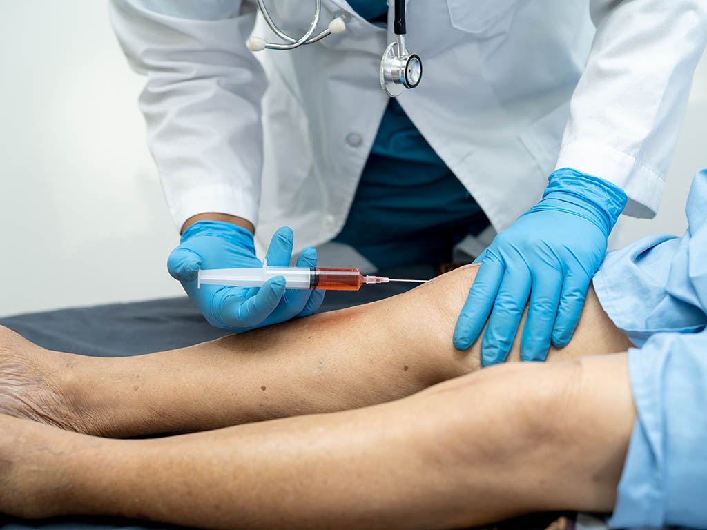 Cortisone Injections for Joint Pain